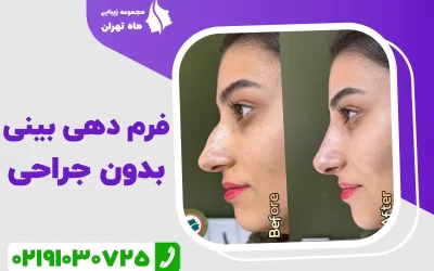 فرم دهی بینی بدون جراحی