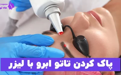 پاک کردن تاتو ابرو با لیزر