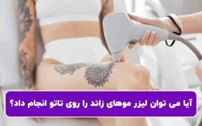 آیا می توان لیزر موهای زائد را روی تاتو انجام داد؟
