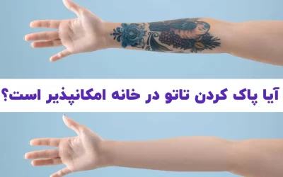 آیا پاک کردن تاتو در خانه امکانپذیر است؟
