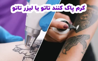 مقایسه کرم پاک کننده تاتو با لیزر تاتو
