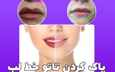 پاک کردن تاتو خط لب