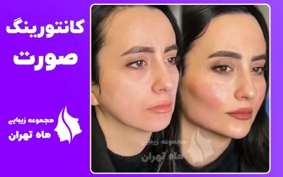 قیمت کانتورینگ صورت در تهران (سال 1405) لیست قیمت جدید