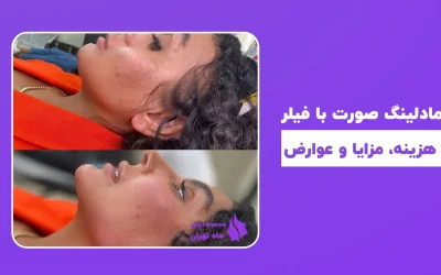 مادلینگ صورت با فیلر