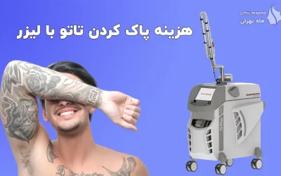 هزینه پاک کردن تاتو با لیزر + لیست قیمت 1405