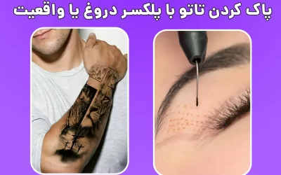 پاک کردن تاتو با پلکسر دروغ یا واقعیت