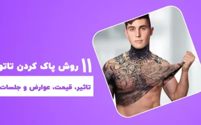 11 روش پاک کردن تاتو