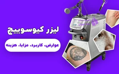 لیزر کیوسوییچ
