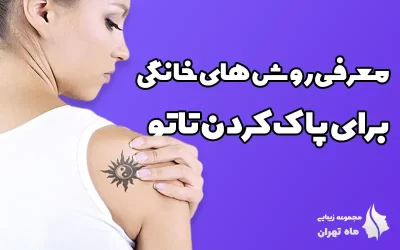 8 روش برای پاک کردن تاتو در خانه