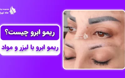 ریمو ابرو چیست؟