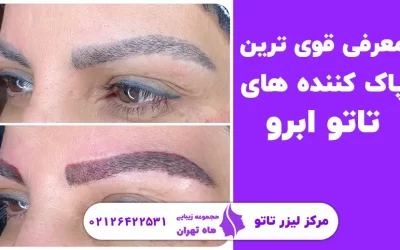 قوی‌ترین پاک‌کننده تاتو ابرو را بشناسید