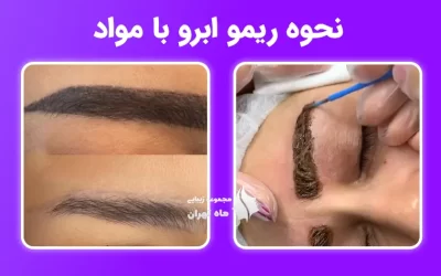 نحوه ریمو ابرو با مواد و عوارض آن