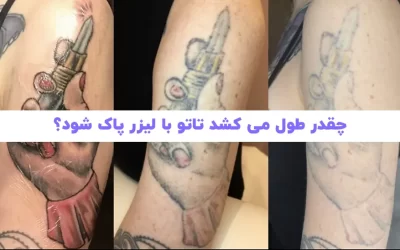 چقدر طول می کشد تا تاتو ابرو و بدن پاک شود؟
