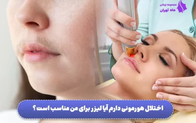 اختلال هورمونی دارم آیا لیزر برای من مناسب است؟