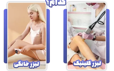 لیزر موهای زائد خانگی یا کلینیک کدام بهتر است؟