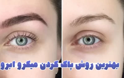 معرفی بهترین روش های پاك كردن ميكرو ابرو