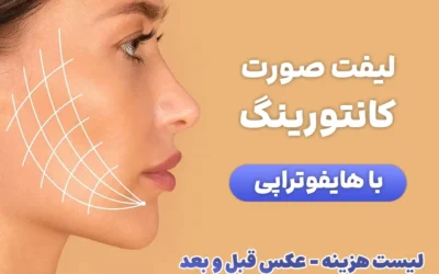 لاغری و کانتورینگ صورت با هایفوتراپی {عکس قبل و بعد}