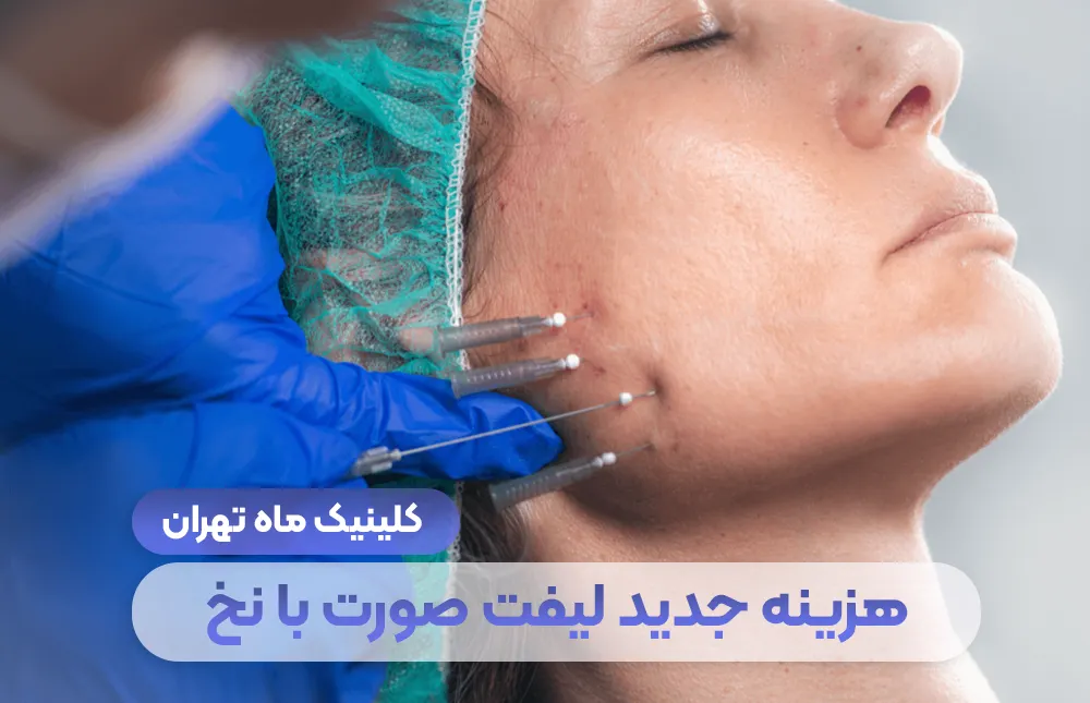 هزینه جدید لیفت صورت با نخ در سال 1405