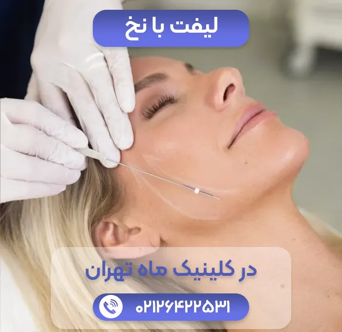 لیفت صورت با نخ در کلینیک ماه تهران