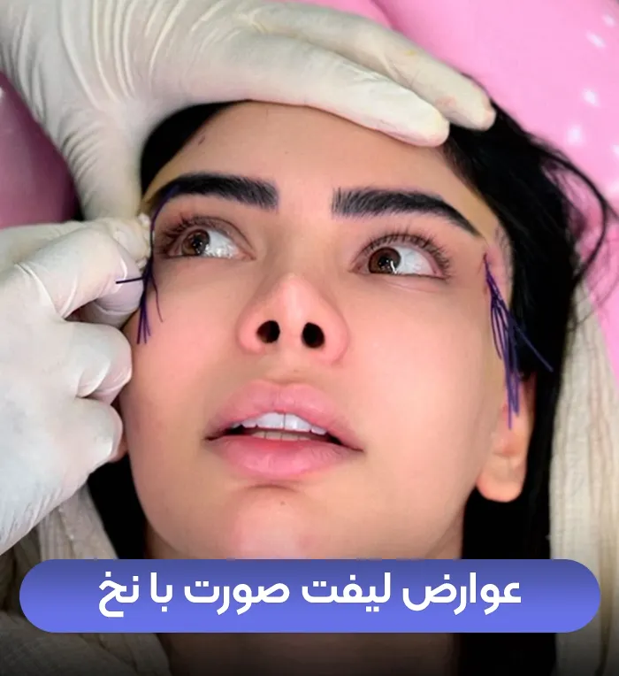 عوارض لیفت با نخ